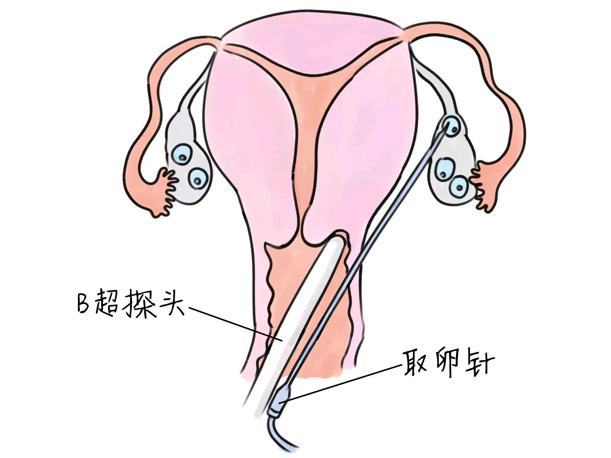 经期同房了怎么办