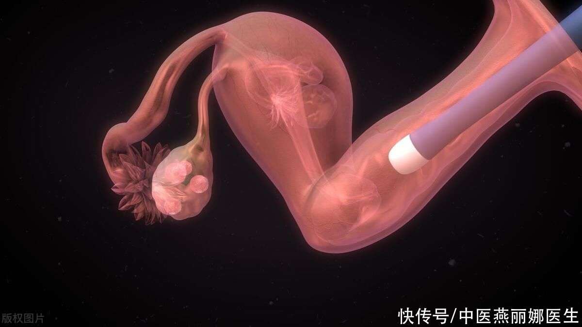 经期大量血块