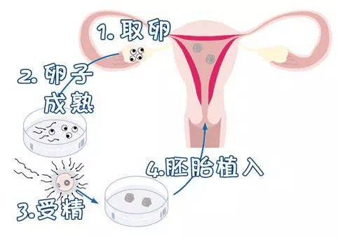 经期性生活