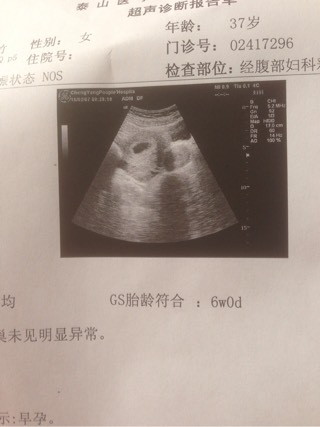 经期戴套同房了怎么办